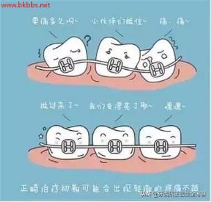 牙齿矫正是不是越快越好?淄博牙齿矫正要多久