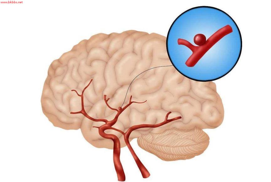 头晕和眩晕如何区分?眩晕恐为疾病前兆!中枢性周围性眩晕大不同