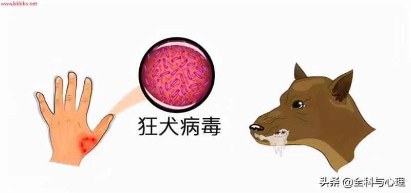 被狗咬了,一定要24小时内打狂犬病疫苗吗?