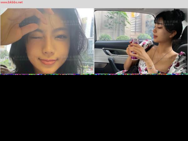 隆鼻手术里的假体,能安全使用几年?鼻整形医生与你说几句实话