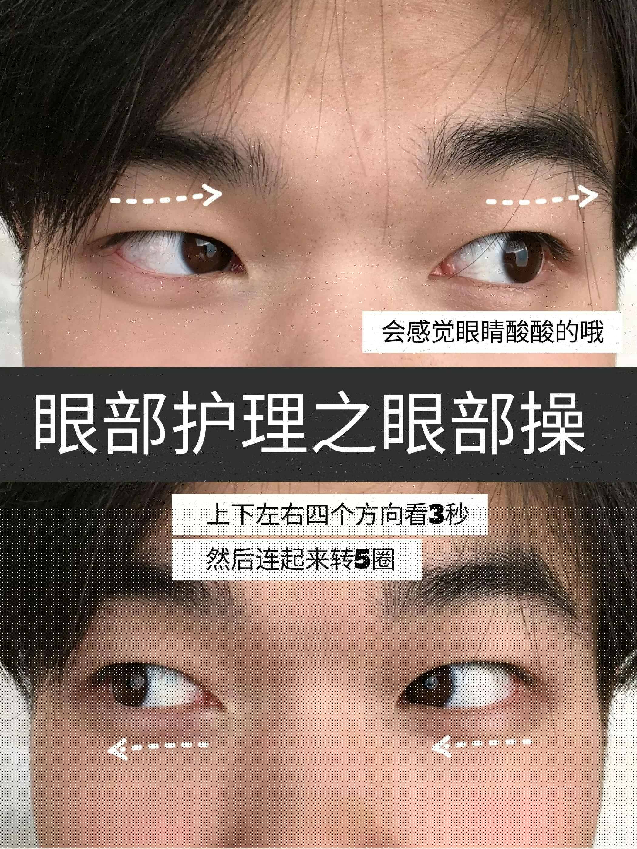 三周淡化黑眼圈全过程的效果反馈!熬夜党冲
