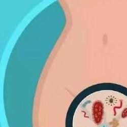 如何正确认识宫颈炎