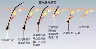 宁波薇琳整形医院祛斑怎么样？还您一张漂亮的容颜