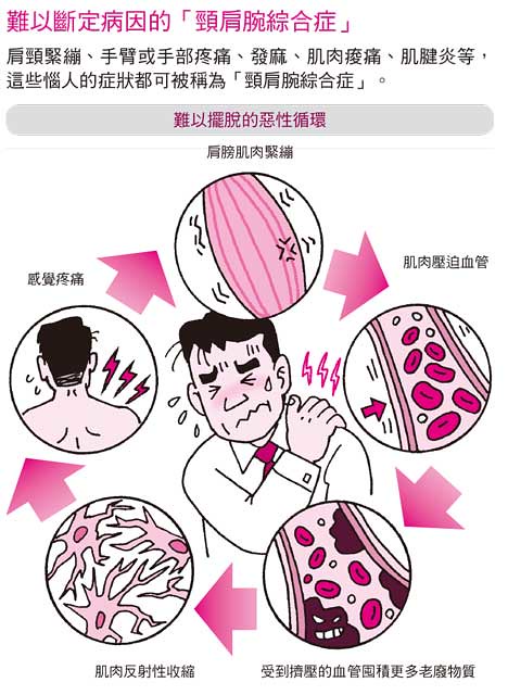 颈肩腕综合症,上班族最易发生
