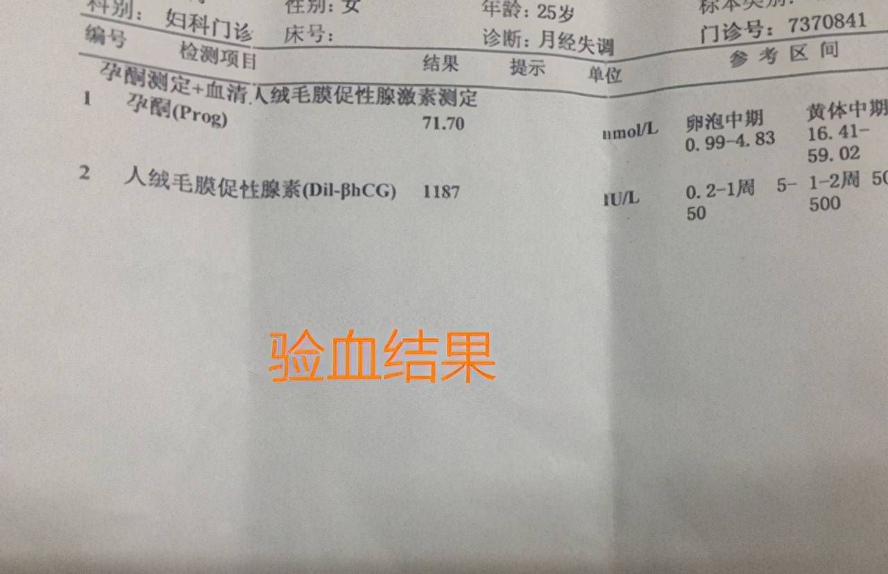 想要确定自己是否怀孕,哪种方式更准确?备孕中的夫妻别大意