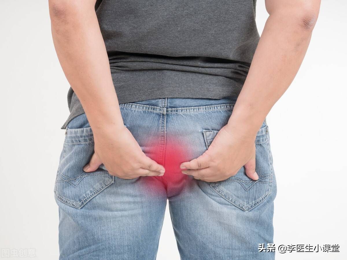 得了痔疮怎么办?医生:2个方法这么用,痔疮肉球没有了