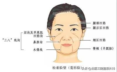 面部吸脂仅仅是瘦脸这么简单吗?