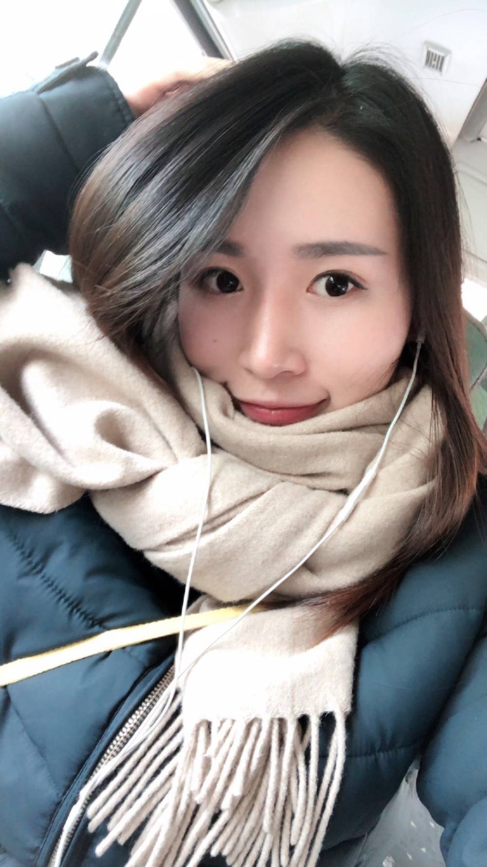 假体隆鼻半个月就不肿了,有些人说鼻梁太高?太假?
