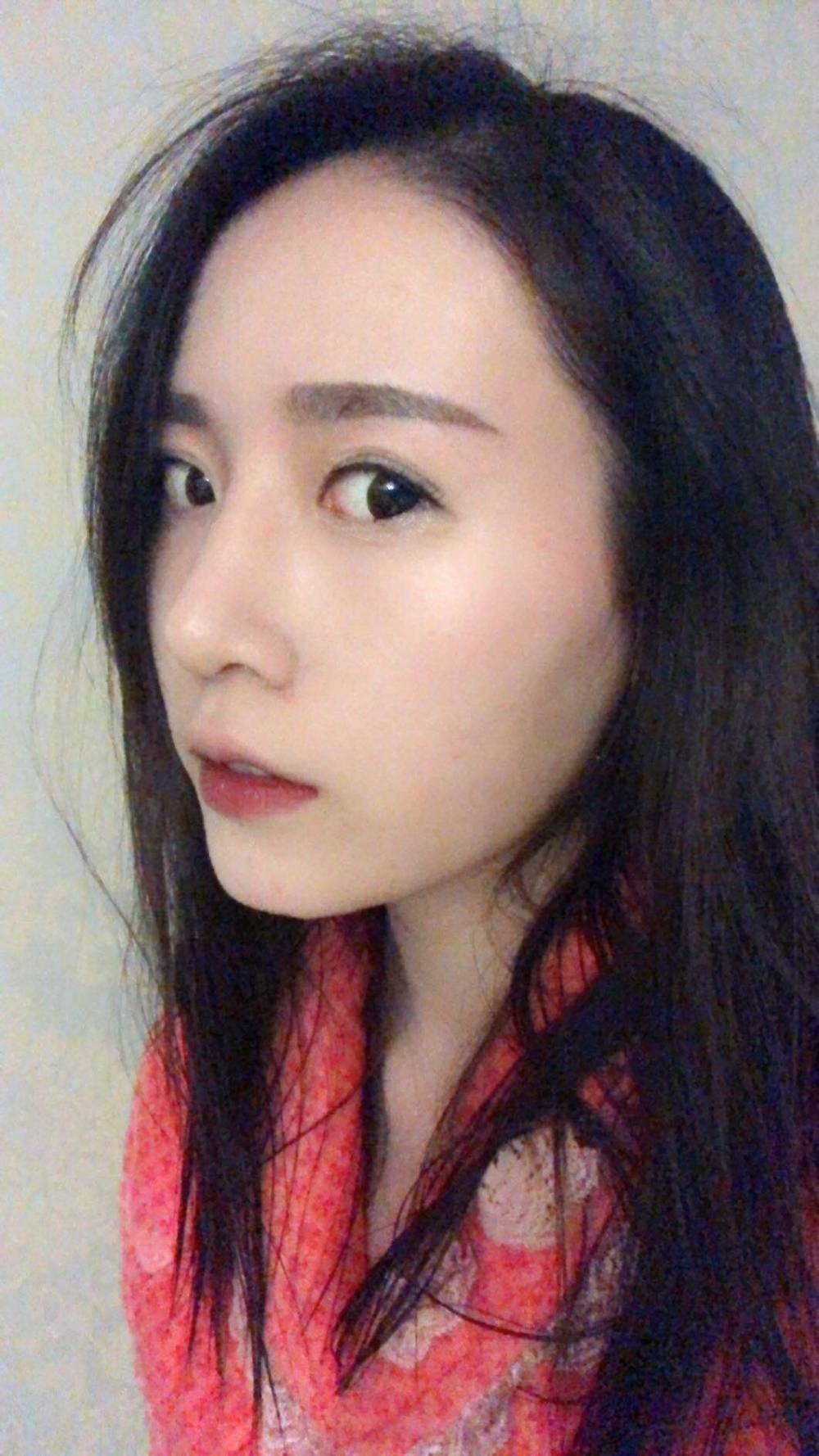 假体隆鼻半个月就不肿了,有些人说鼻梁太高?太假?