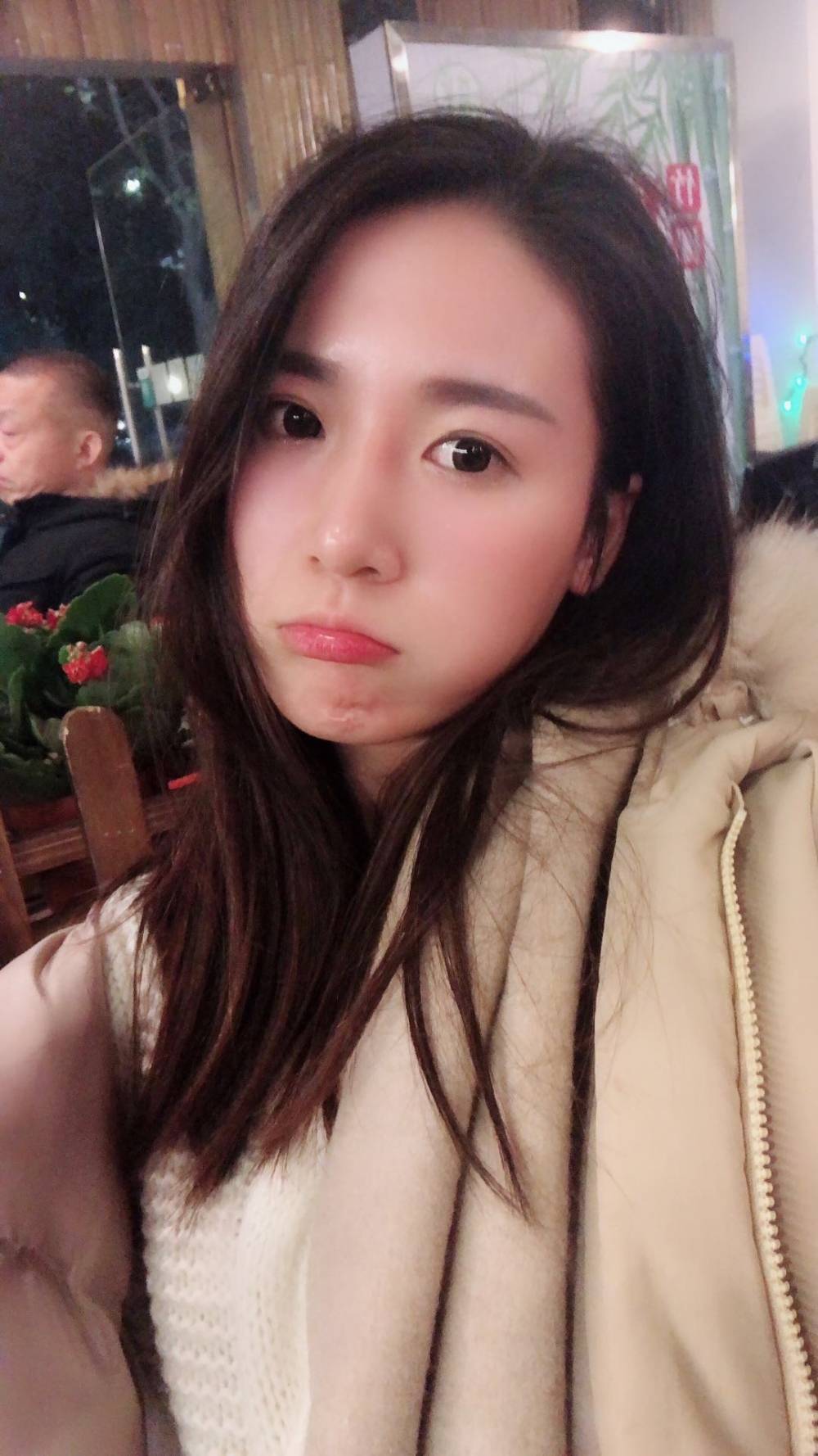假体隆鼻半个月就不肿了,有些人说鼻梁太高?太假?